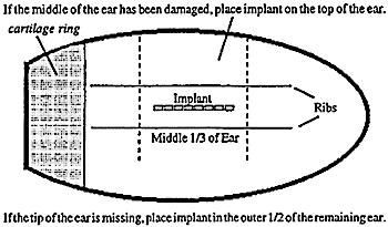 Picture showing where implant goes.